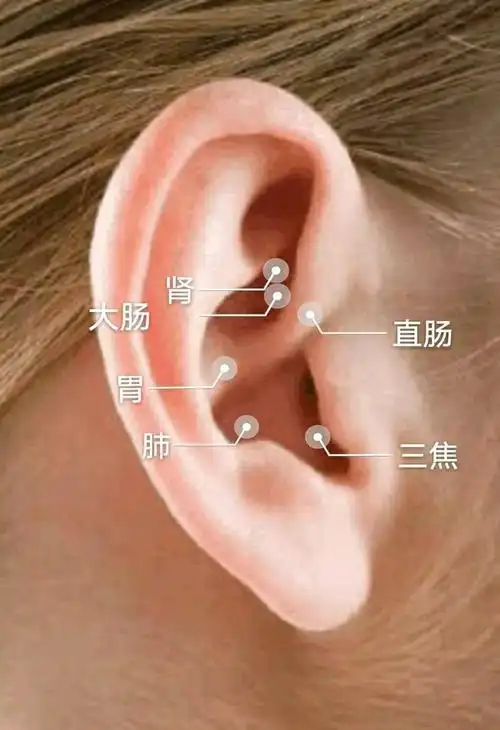 耳穴调便秘简单上手见效快