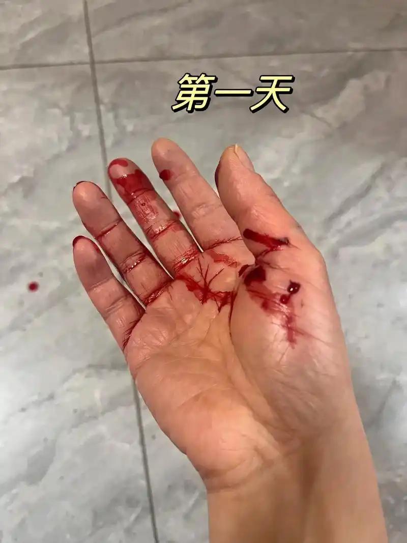 被狗咬伤伤口不能包扎的,你可以去百度,不然伤口很难愈合的, 3月恰い