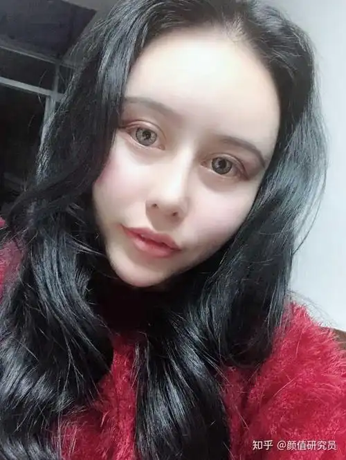 双眼皮想做欧式 适合吗?