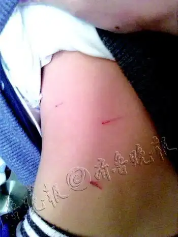 一起"童伤案"背后的空白点