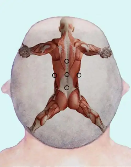 郑卫东老师全息针灸讲课笔记