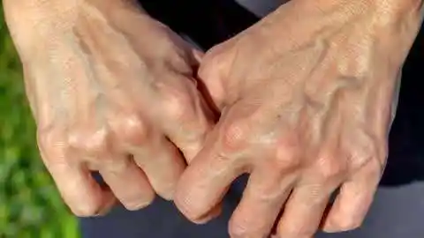 手上青筋凸起,说明这些部位出现了问题!