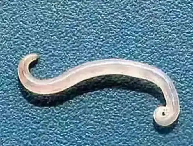 肛门爬出20多只小虫子肛门里爬出一根虫子