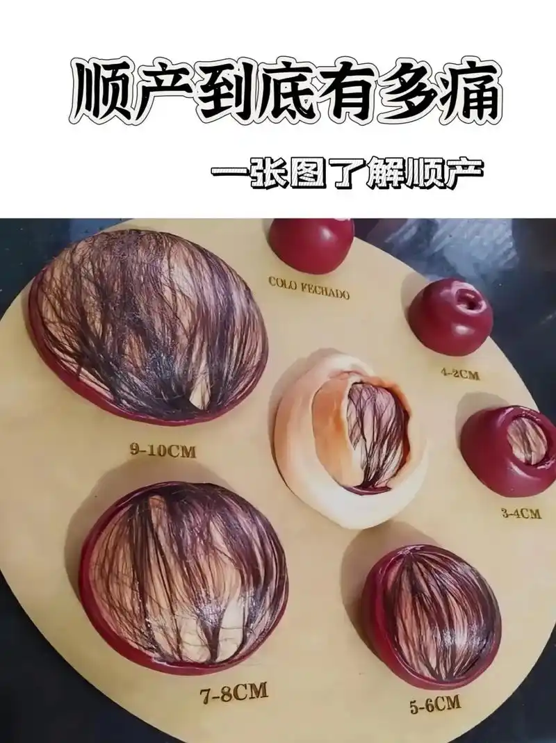 一张图了解顺产 这张图反映的胎头直径是"双顶径"