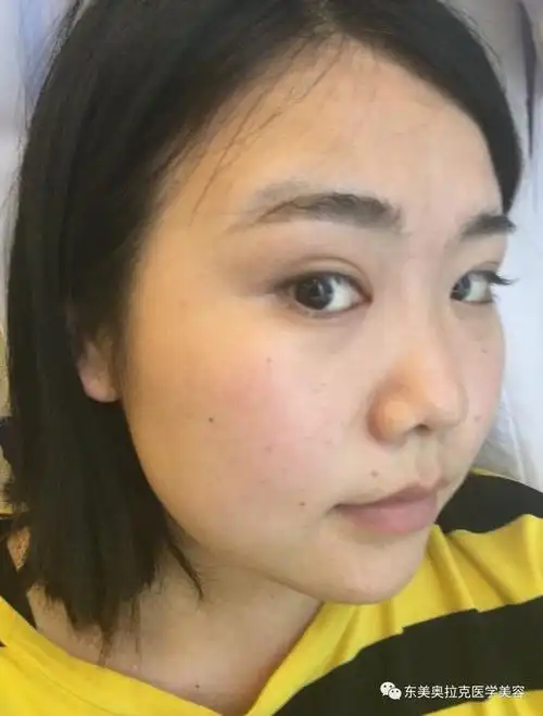 大饼脸的妹子你自卑吗拯救大饼脸塌鼻子用这个方法肯定行