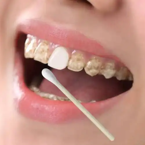 牙上的斑竟能伤害全身,你还不注意?赶紧洗洗干净吧