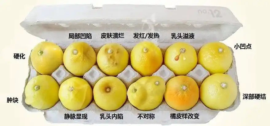 乳头有溢液或者溢血;乳房皮肤呈现橘子皮状;乳头短期内变为内凹(先天