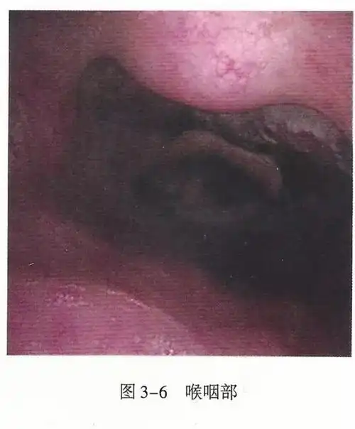 必备,上呼吸道解剖详解