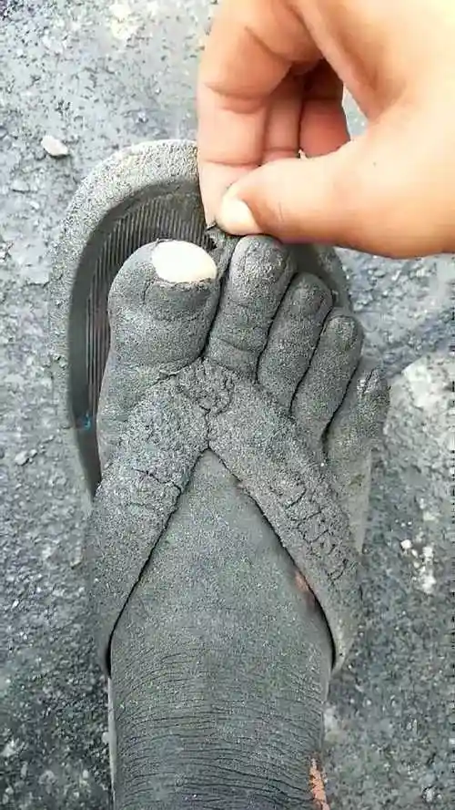 这是多久没洗脚能有这个状态