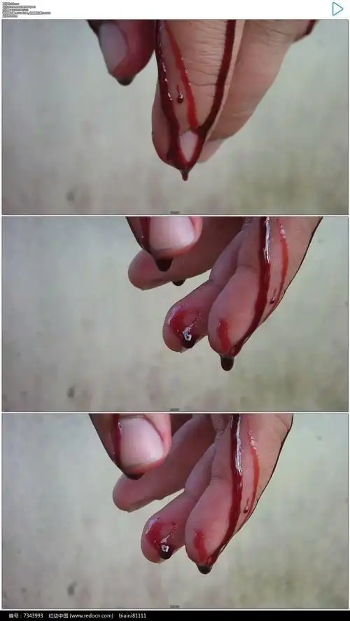 手指鲜血往下滴实拍视频素材