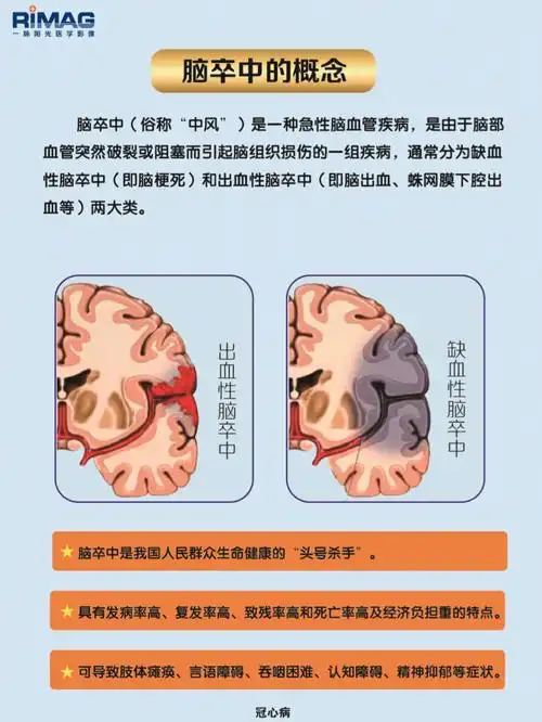 正确认识脑卒中有这些症状的人要注意了