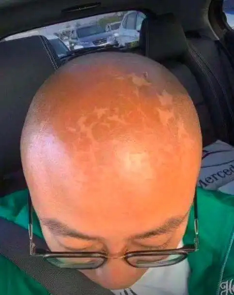 哇一个光头卤蛋这造型也是没谁了