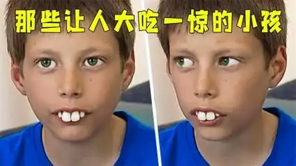 这些小孩在学校被欺负,但几年后的他们却让每个人大吃