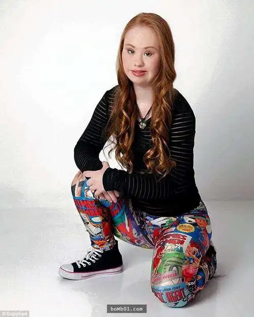 澳洲有名模特竟然是唐氏症患者