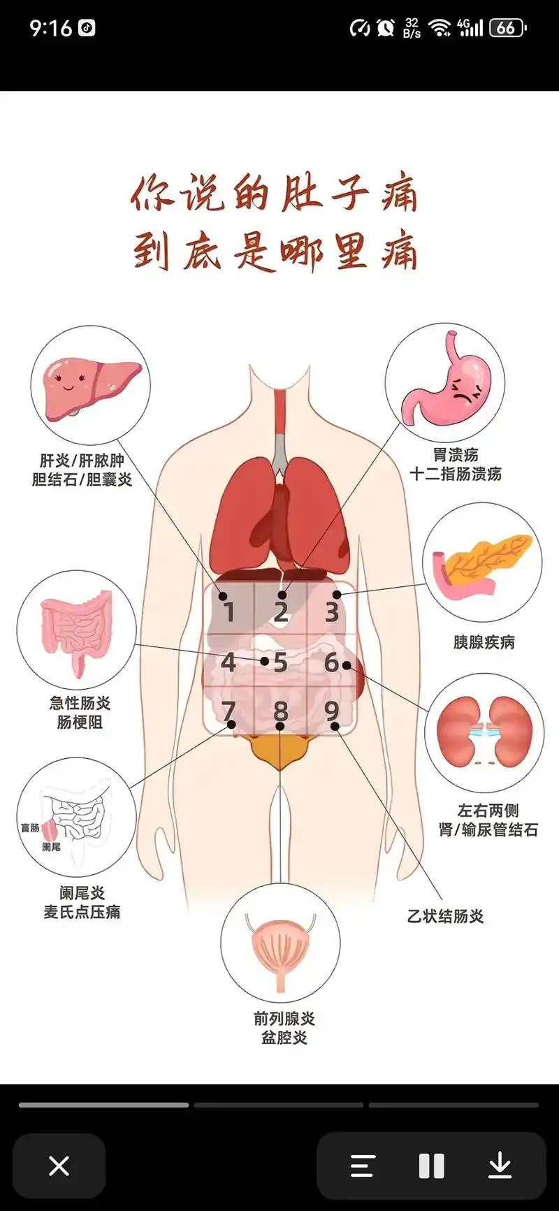 右下腹疼了好几天了,自己查查什么原因,一查吓死你,以后好好爱 - 抖音