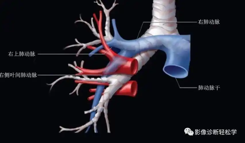 肺部hrct读片之三肺动脉