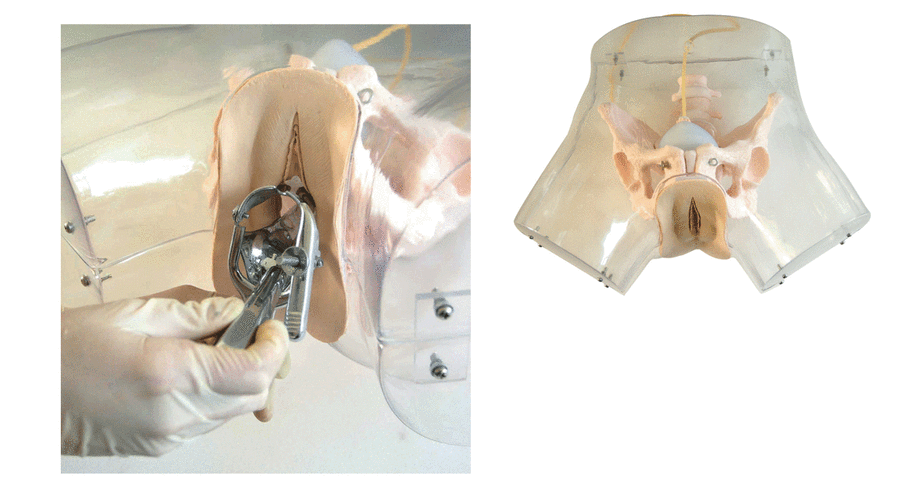 清宫术(其他人物相关)清宫术即刮宫,清宫术是早期人工流产最常采用的