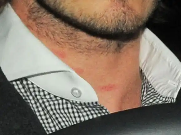 脖子处明显的累累吻痕