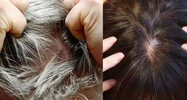 白发变黑效果最好的土方法:照做不出10天头发洗出乌黑柔顺!