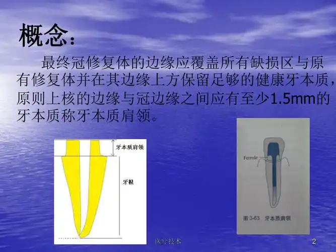 牙本质肩领的概念(严选内容)