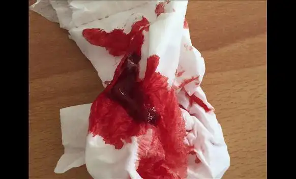 男人看女人流鼻血是什么原因