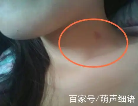 小学女孩脖子出现"草莓",父母强行逼问,女儿的话让父母自责