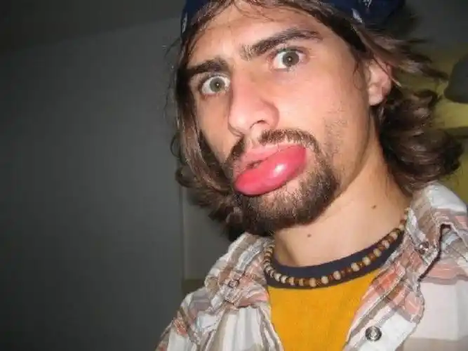 buzz网友po了一些自己被蜜蜂蛰了嘴唇的皂片出来,我知道挺疼的,但还是