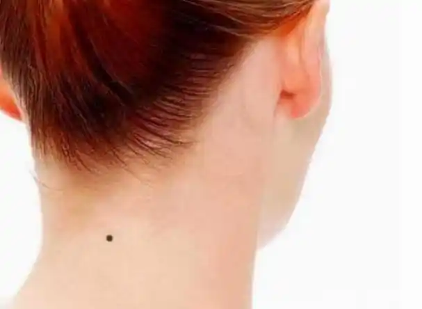 后颈有痣代表什么 后颈有痣的男人好吗