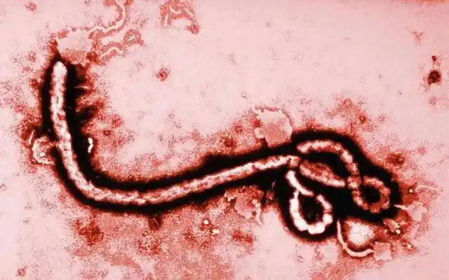 新冠在它面前都得喊声爷,感染埃博拉病毒的患者90%都会死亡,且死前的