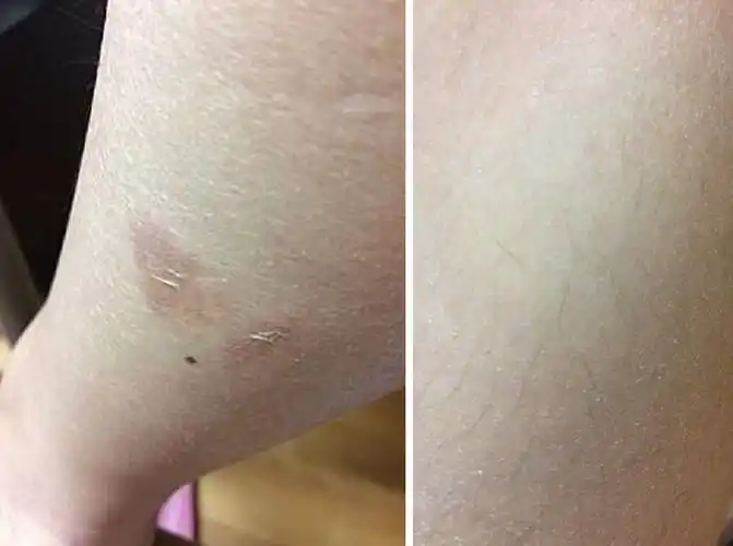 过敏人泪推温和aveeno家族～沐浴露 保湿乳