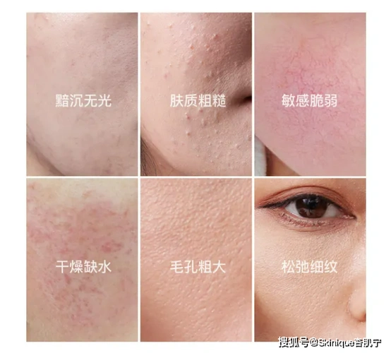 什么是屏障受损如何修复屏障受损