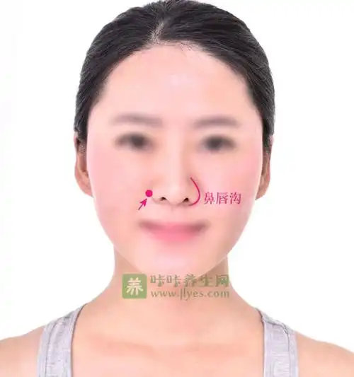 迎香穴位位置 标准定位:迎香穴在鼻翼外缘中点旁,当鼻唇沟中.