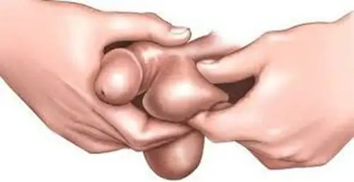 睾丸的详细结构图片_有来医生