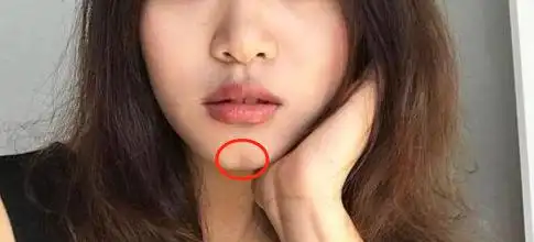 美人沟是指在下巴的中间有一条浅浅的沟,在西方又叫欧米伽型下巴(w型