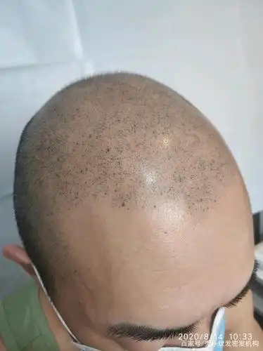 最近卓林发现度娘旗下的贴吧–纹发吧现存大多数的帖