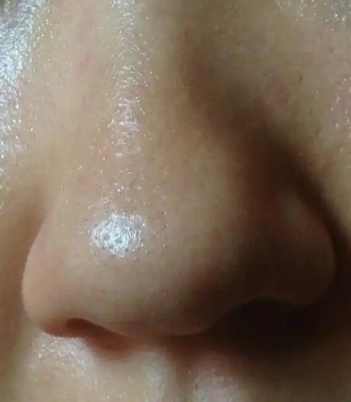 如何控制它们产生?