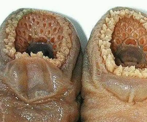 空手指莲蓬乳发病原因 太恶心胆小的不要看