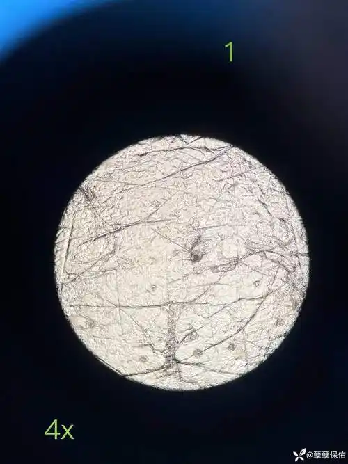 背部痘痘显微镜观察