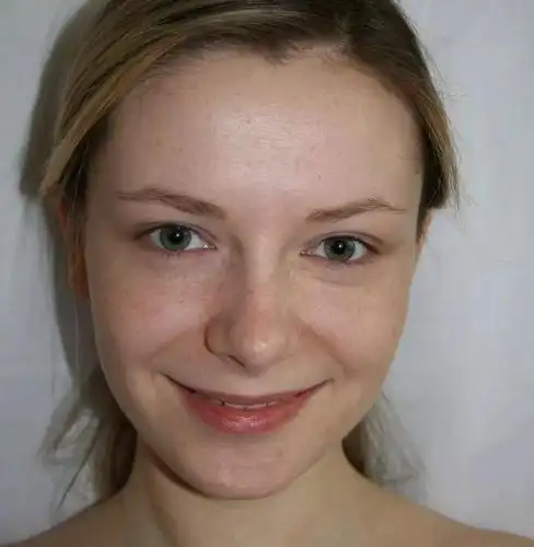 设计小妙招ps人物祛斑