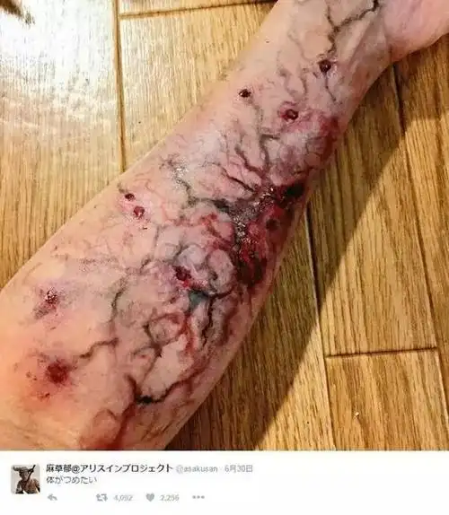 日本一男子被咬到后的惊人变化.