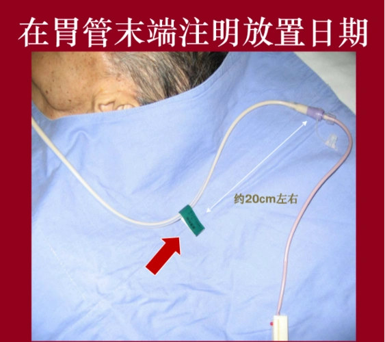 规范操作 提升能力 扎实基础——豫东医院"留置胃管操作技术"考试纪实