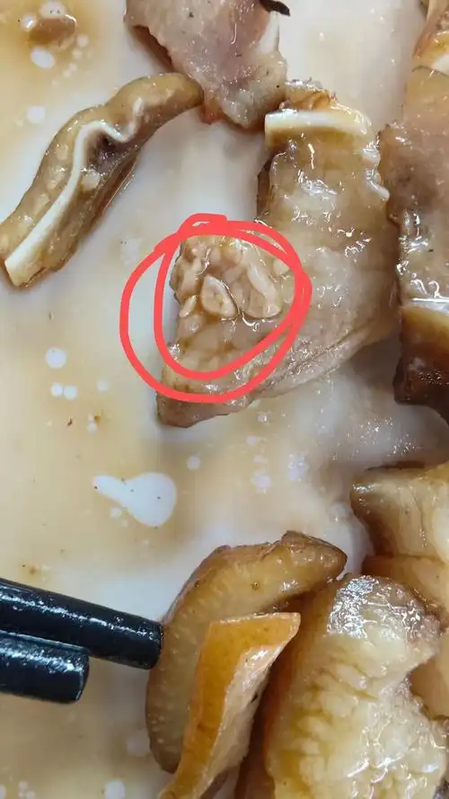 learning to 的想法: 帮忙看看这块是不是淋巴肉 | 请问,这是淋巴肉