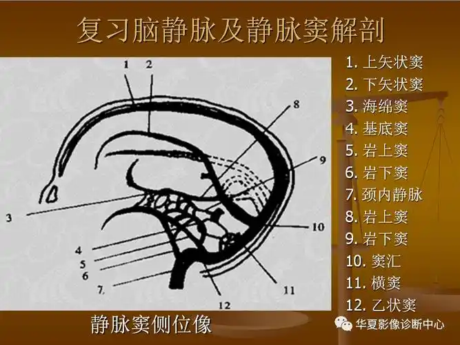颅脑ct看到这个征像别忘记静脉窦血栓