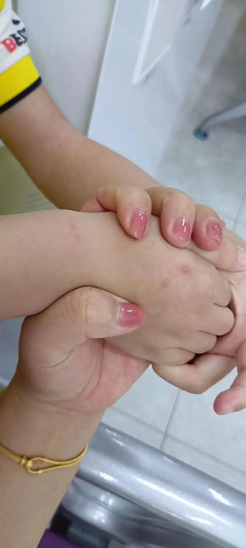 中奖了,手足口病 - 抖音