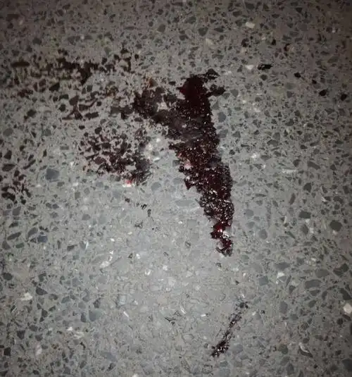 揪心昨晚吉安县二中一名学生放学过马路被撞飞倒地不起