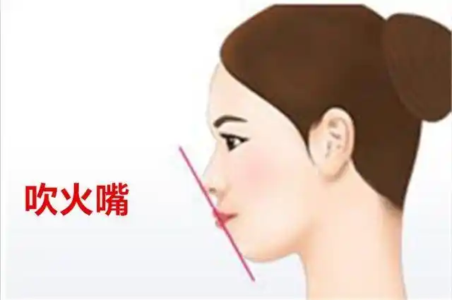 老话"女不嫁驼背,男不娶吹火嘴",到底是什么意思? - 说说句子网