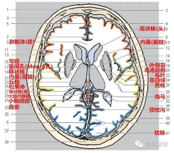 【解剖入门】颅脑ct断层(中英文对照)