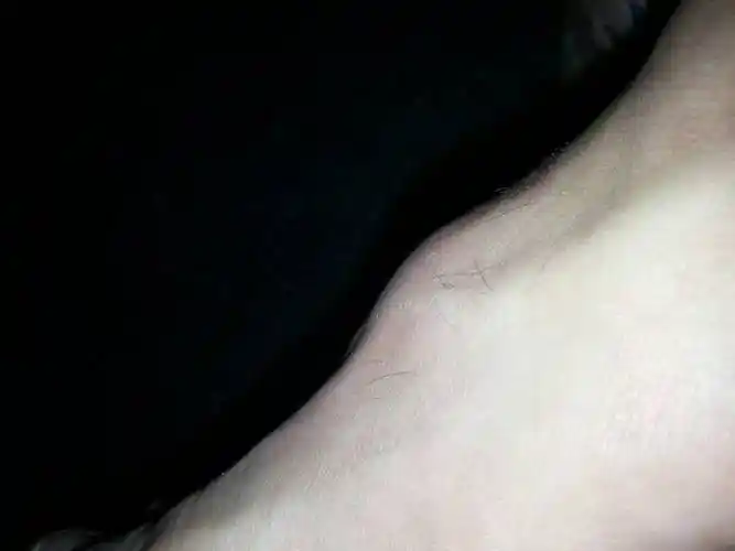 请问我脚背有骨头凸起来,很硬不痛,不知道是什么,我穿鞋子搞到的,我