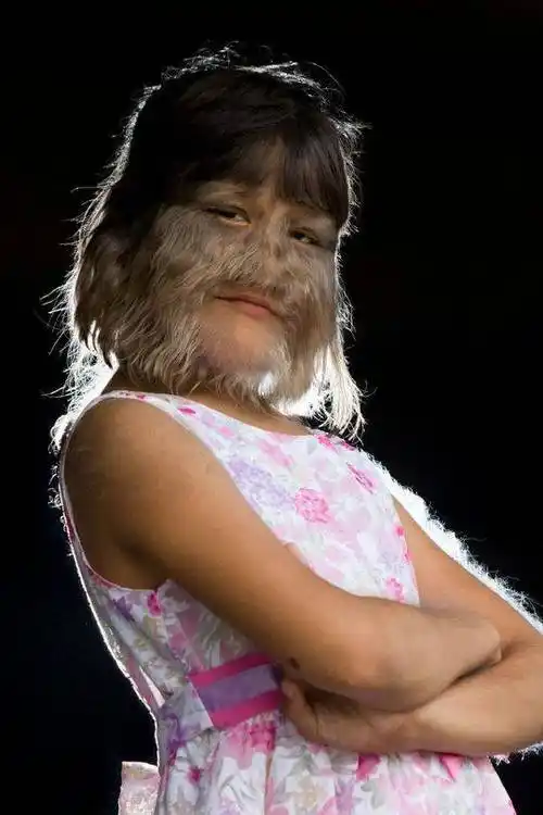 世界面部多毛女孩结婚了 剃毛露真容与丈夫合影