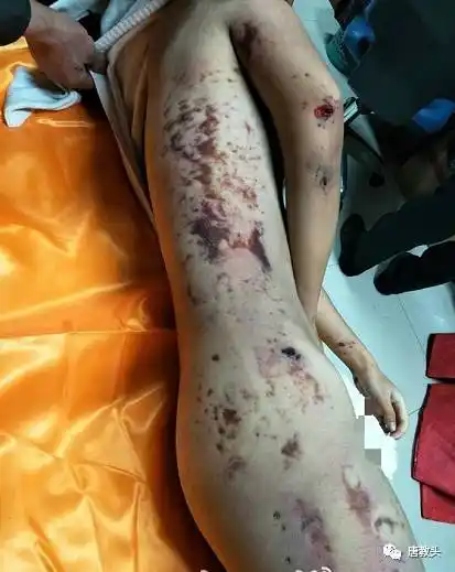 【又一起】震惊!高校一女大学生裸体坠楼身亡,尸体满身伤痕淤青-搜狐